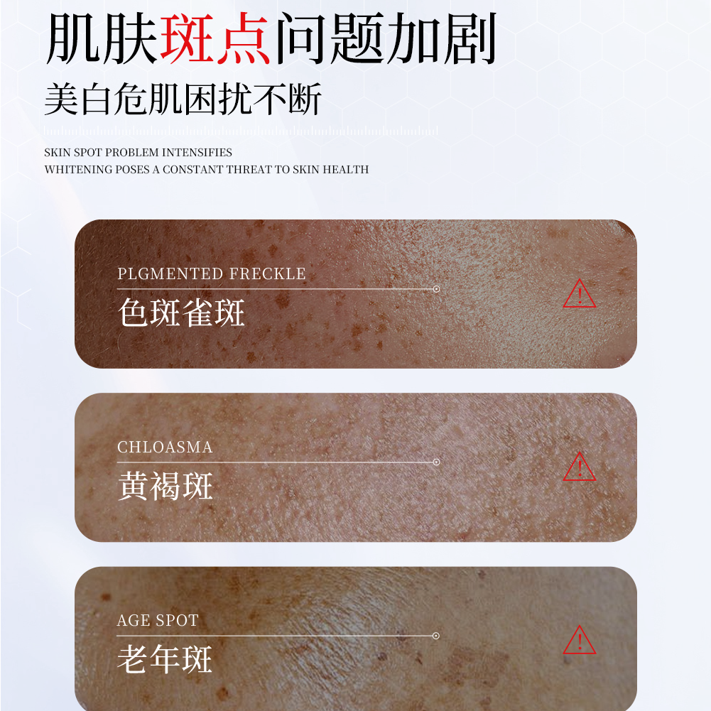 七片装袪斑贴详情页 拷贝-03.png